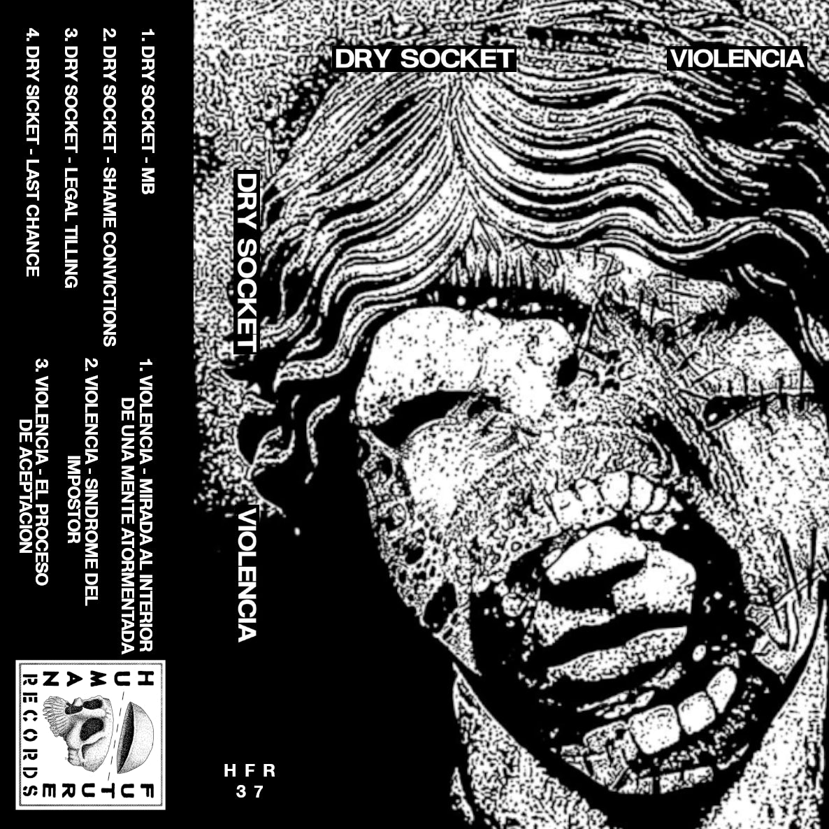 Cassette tape cover for Dry Socket//Violencia Split by Cease & Desist Records, featuring bold graphic design on the cassette packaging.